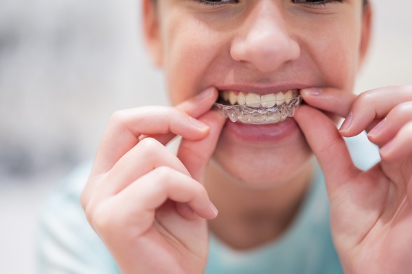 What to Ask Your General Dentist About Clear Braces for Teeth