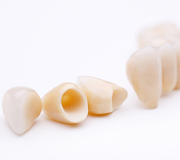 Livermore Dental Crowns and Dental Bridges