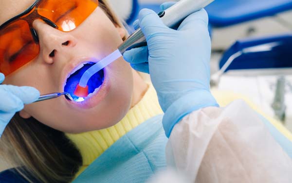 Dental Filling For A Cavity