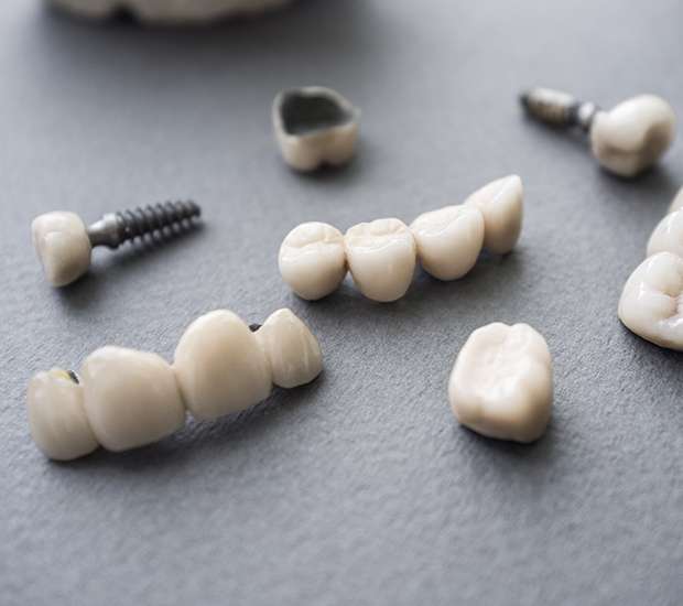 Livermore The Difference Between Dental Implants and Mini Dental Implants